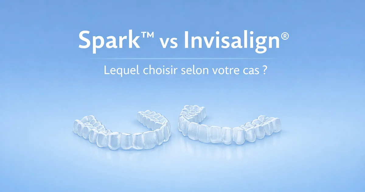 Comparatif Spark vs Invisalign